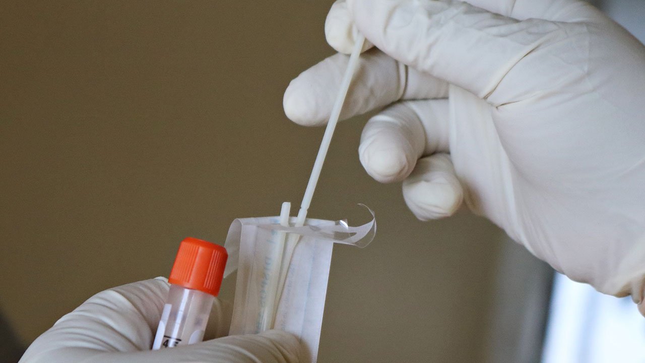 PCR-Test